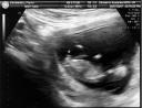 Looks like we'll have a boy [Ultrasound3.jpg]