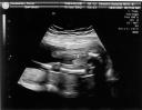 It's a boy! [Ultrasound9.jpg]
