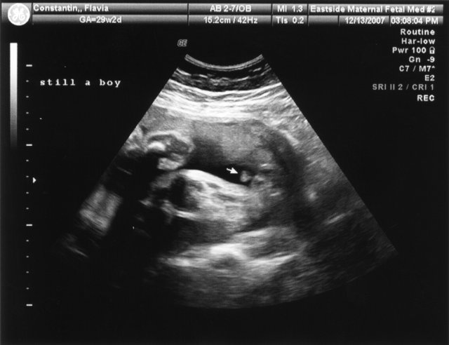 At 29 weeks, still a boy! [Ultrasound17.jpg]