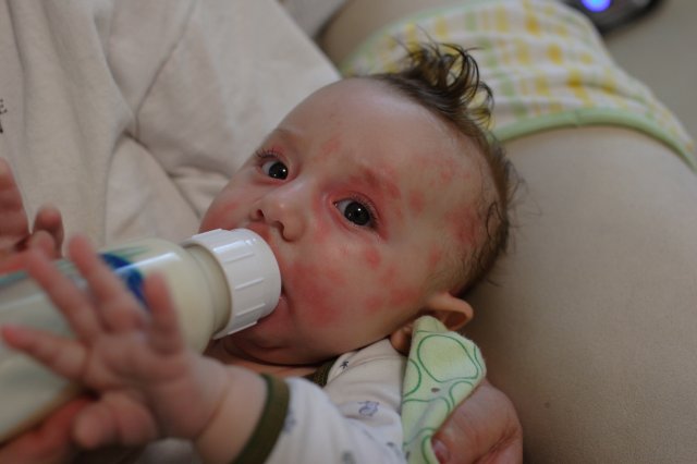 Alin Constantin's Photography - Allergic reaction
(Click on the picture for the full-size version)